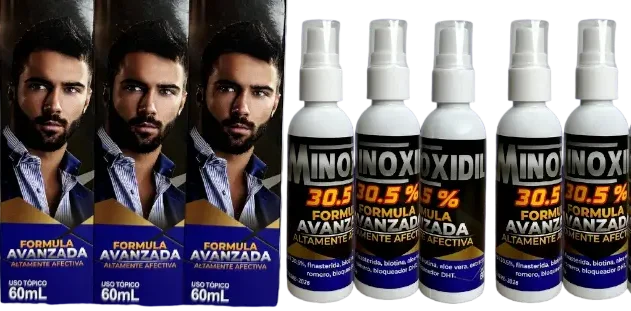 minoxidil mens